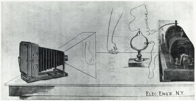 Teşhis Radyoloji, X-ışınları X-ray fotoğrafçılığı by John Pardon