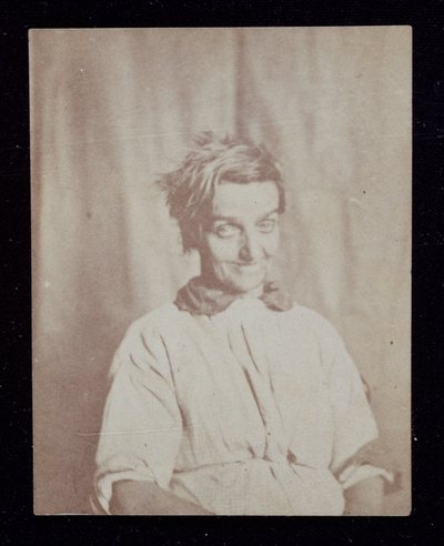 Bir hastanın Psikiyatri Portresi, Surrey County Asylum, c 1852 by John Pardon