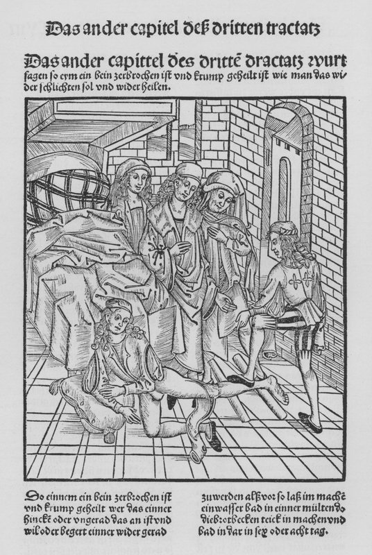 Sirurgia Kitabı, Hieronymus Brunschwig (lito) by (after) German School