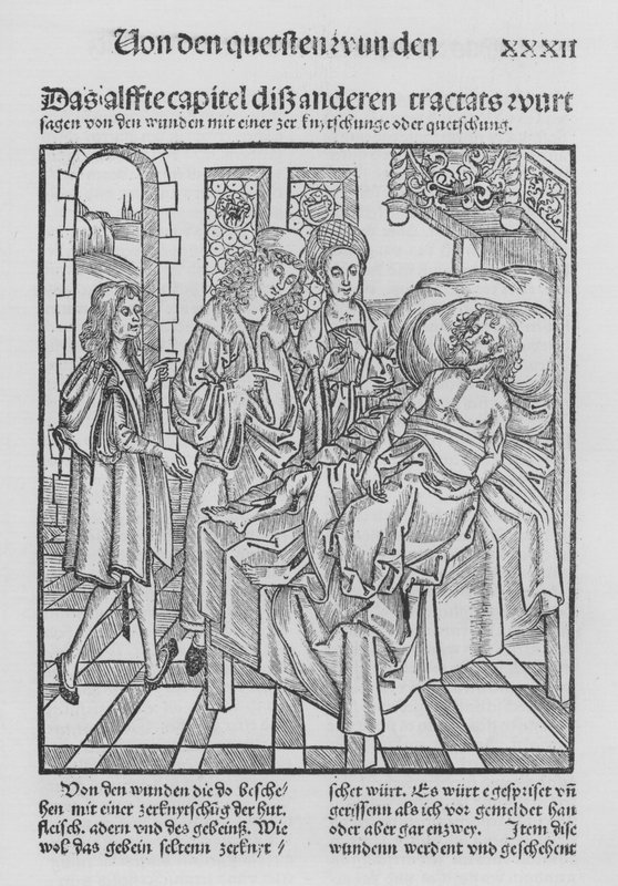 Sirurgia Kitabı, Hieronymus Brunschwig (lito) by (after) German School