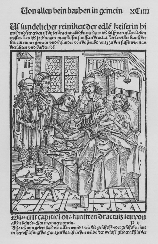 Sirurgia Kitabı, Hieronymus Brunschwig (lito) by (after) German School