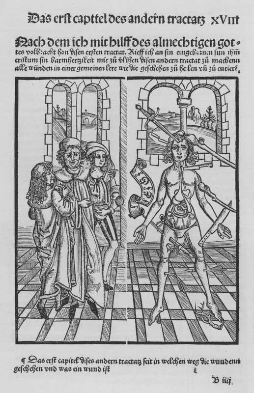 Sirurgia Kitabı, Hieronymus Brunschwig (lito) by (after) German School