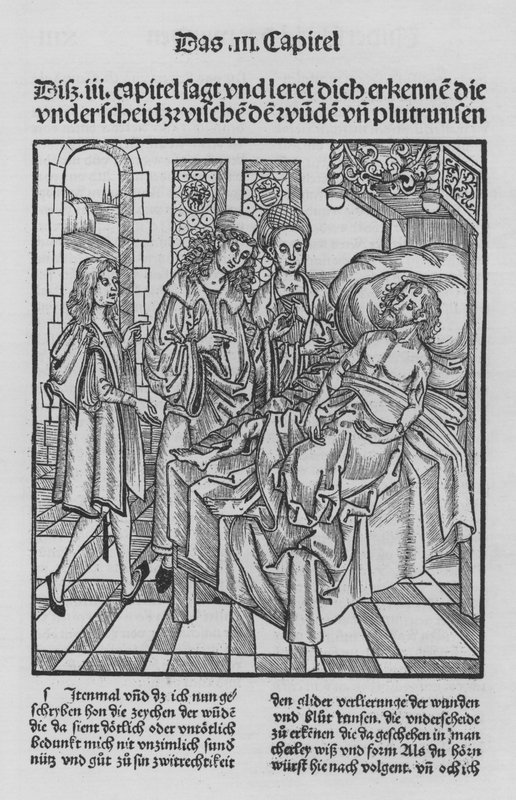 Sirurgia Kitabı, Hieronymus Brunschwig (lito) by (after) German School