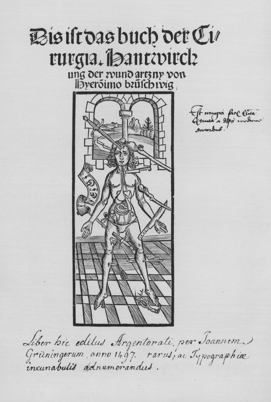 Sirurgia Kitabı, Hieronymus Brunschwig (lito) by (after) German School