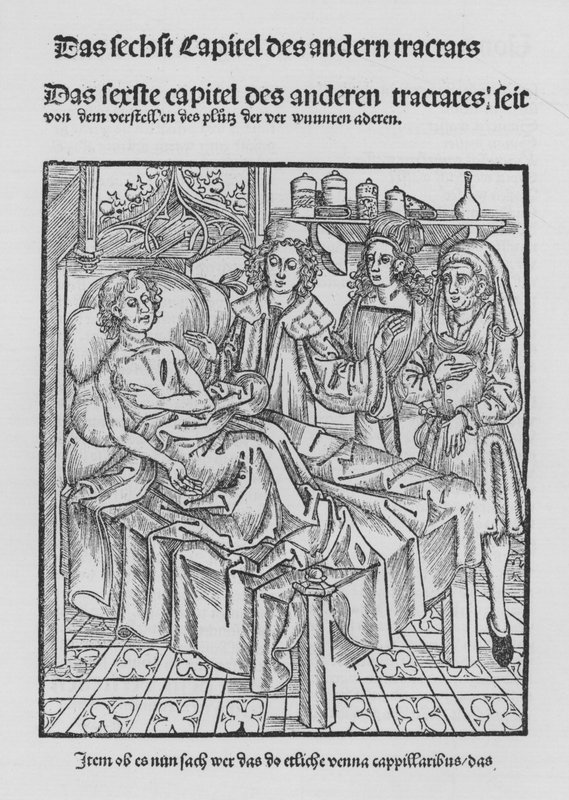 Sirurgia Kitabı, Hieronymus Brunschwig (lito) by (after) German School