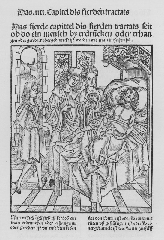 Sirurgia Kitabı, Hieronymus Brunschwig (lito) by (after) German School