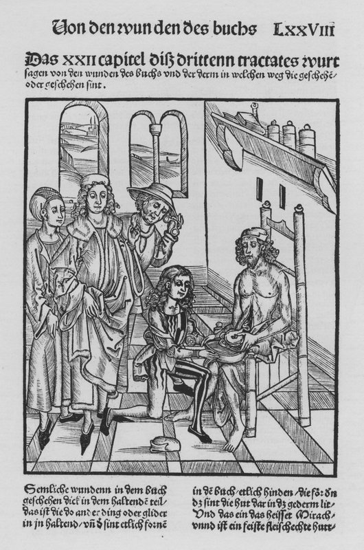 Sirurgia Kitabı, Hieronymus Brunschwig (lito) by (after) German School