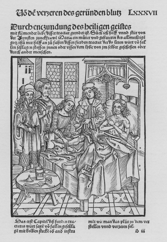 Sirurgia Kitabı, Hieronymus Brunschwig (lito) by (after) German School