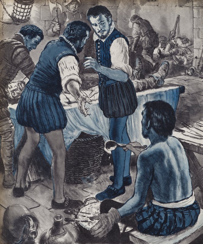 Ambroise Pare, askeri cerrah, petrol bittiğinde (taş) by English School