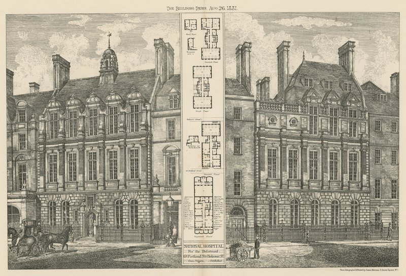 Deforme, Great Portland Street ve Bolsover Street Ulusal Hastanesi by English School