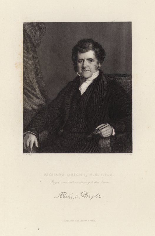 Richard Parlak by English School