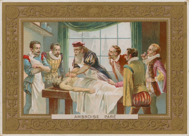 Ambroise Pare, 16. yüzyıl Fransız cerrahı by French School