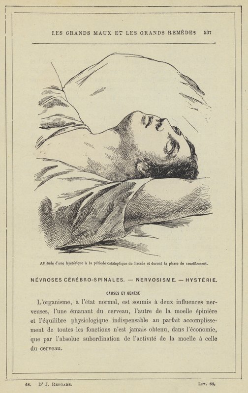 Erişimin kataleptik döneminde ve çarmıha gerilme aşamasında bir histerik tutumu (renkli lito) by French School