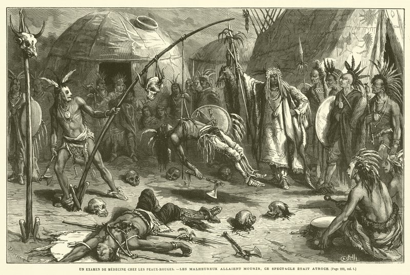 Redskins Arasında Tıbbi Bir İnceleme (gravür) by French School