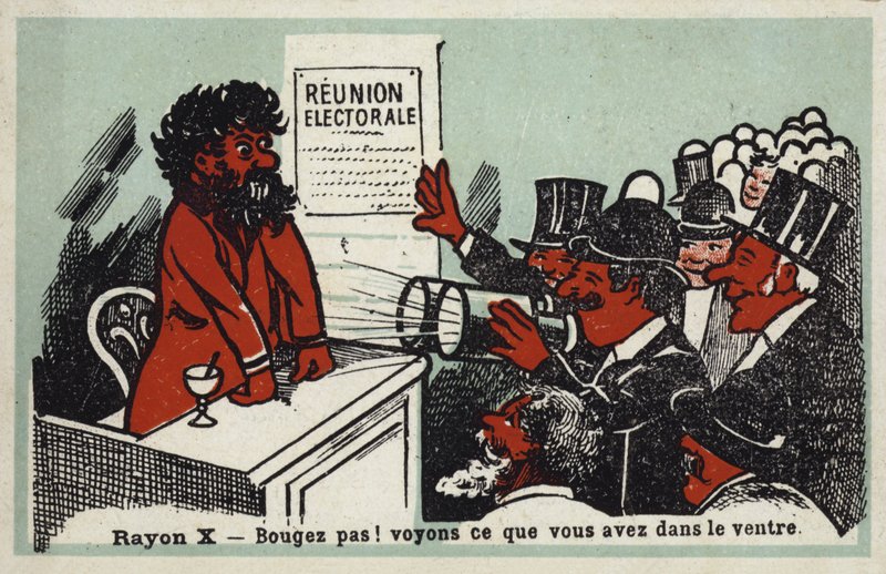 X ışınları - Kımıldama! Bakalım midesinde ne var by French School