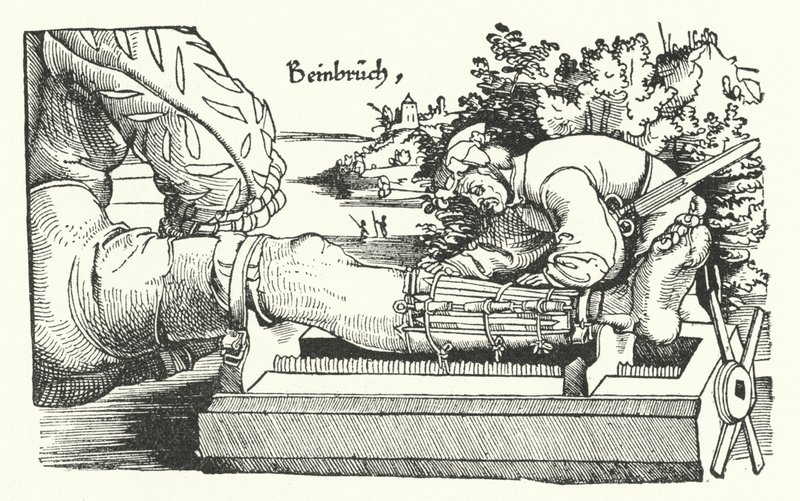 Kırık bir bacağın tedavisi (gravür) by German School