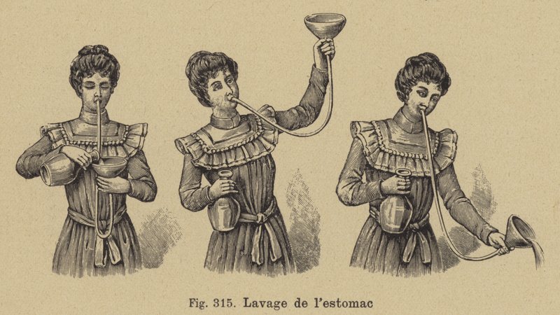 Mideyi yıkamak by German School