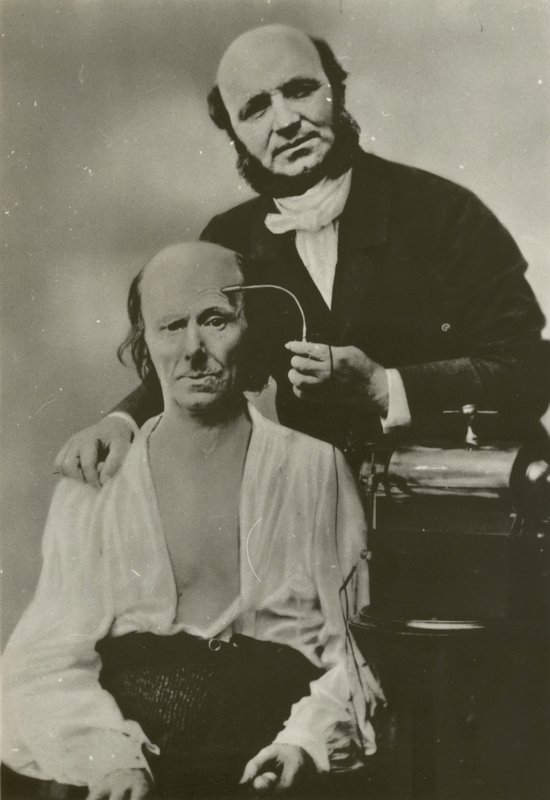 Fransız nörolog Duchenne de Boulogne, elektrofizyoloji cihazını yaşlı bir adam üzerinde kullanıyor. by Guillaume Benjamin Armand Duchenne de Boulogne