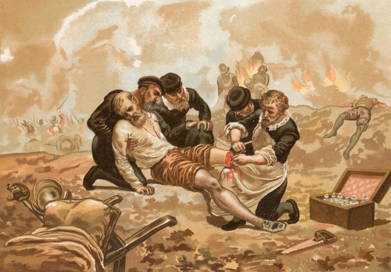 Damar bağlarını tanıtan Ambroise Pare by Josep or Jose Planella Coromina