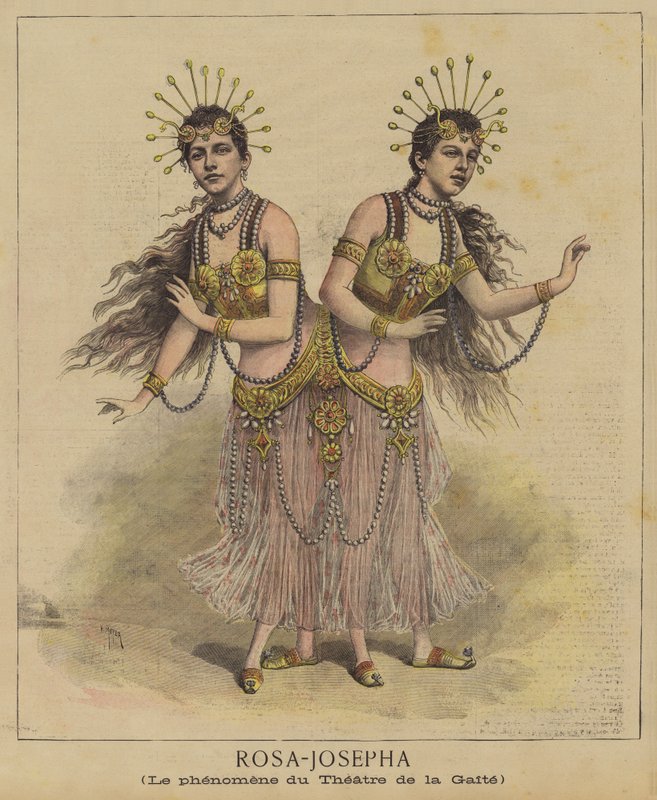Siyam ikizleri by after Henri Meyer